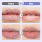 🎁LIMITED SALE - BUY 1 GET 1 FREE!!💕Plumping & Anti-Wrinkle Hydrating Lip Serum